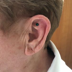 Stress Relief New Green Earring Magnet Acupressure